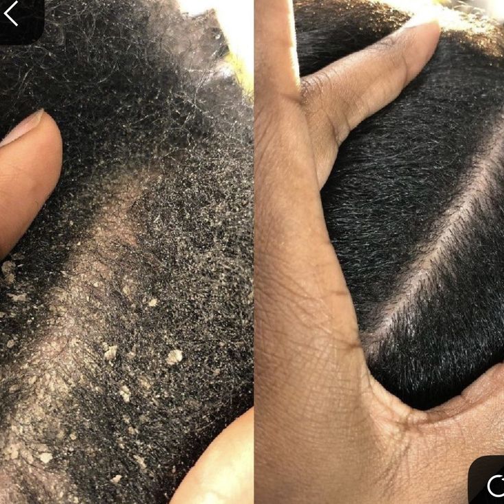 (1) > SMALL KNOTLESS BOX BRAID / BOX BRAID (MID-BACK > $250) (WAIST-LENGTH  $300) WITH HAIR INCLUDED > SCROLL FOR MORE SIZES, BOOK YOUR APPOINTMENT. CLICK ON ANY PICTURE OF SIZES YOU WANT TO BOOK.
