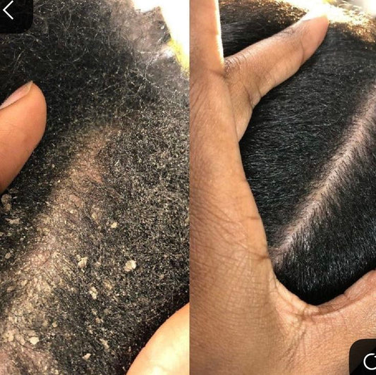 (W) > TAKE DOWN BRAIDS